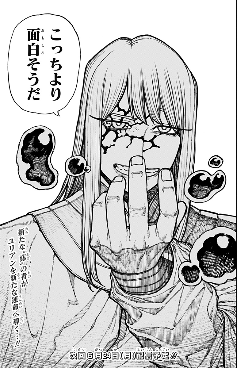 49