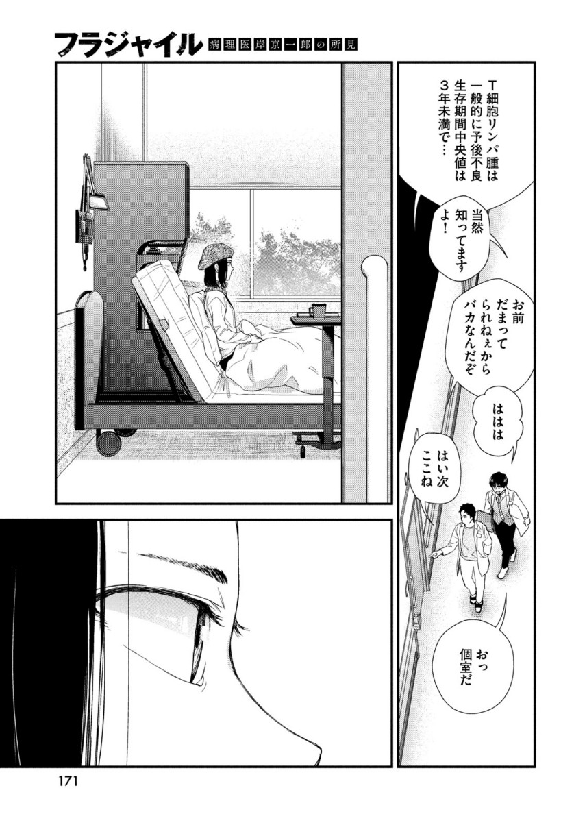 33