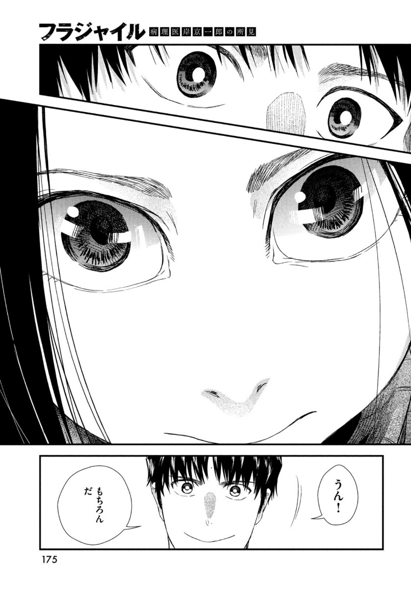 37