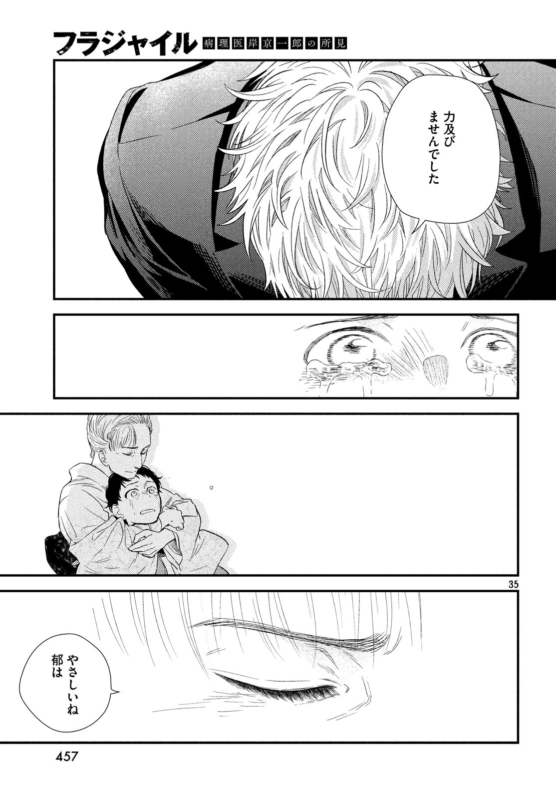 35