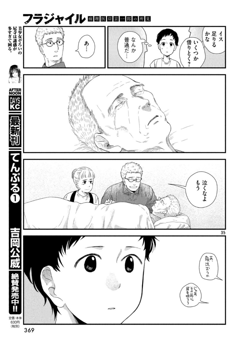 35