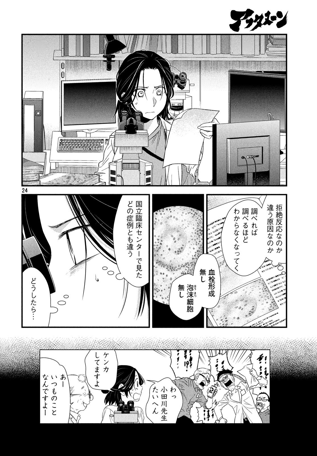 24